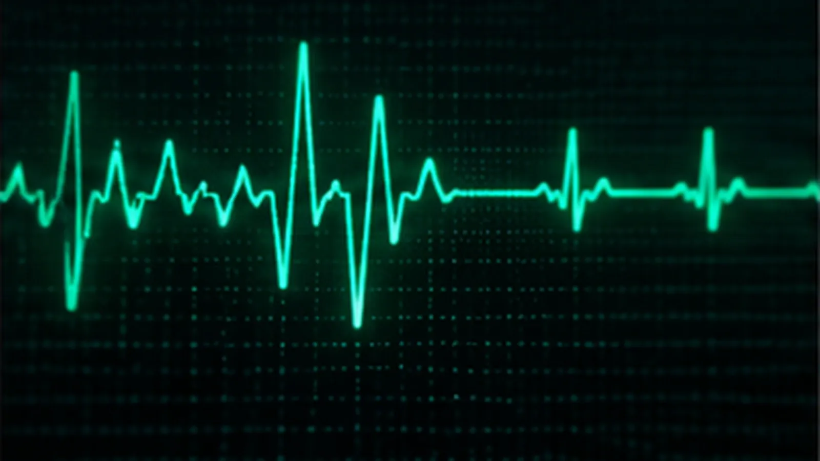 A glowing green heart-rhythm trace on a monitor, irregular at first and then steady